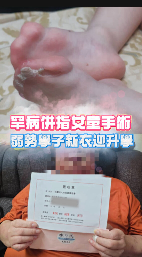 罕病併指女童手術,弱勢學子新衣迎升學封面