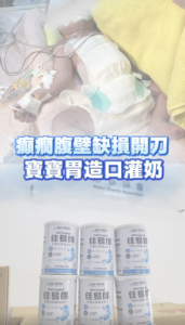 癲癇與腹壁缺損寶寶接受胃造口灌奶及特殊配方奶粉協助